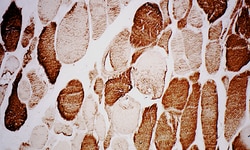 Biogenex Laboratories Actin, Muscle: HHF35 : 6mL, Quantity: Each of 1
