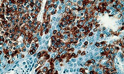Biogenex Laboratories CD45 : PD7/26/16 & 2B11 : 6mL, Quantity: Each of