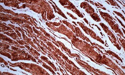 Biogenex Laboratories Actin : 1A4 : 6mL, Quantity: Each of 1