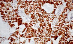 Biogenex Laboratories Cytokeratin 8 : C51 : 6mL, Quantity: Each of 1