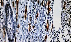 Biogenex Laboratories CD34 : QBEnd/10 : 6mL, Quantity: Each of 1