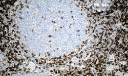 Biogenex Laboratories CD3 : PS1 : 100 test, Quantity: Each of 1