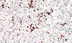 Biogenex Laboratories CD71 : H68.4 : 6mL, Quantity: Each of 1