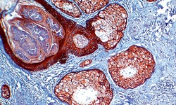Biogenex Laboratories Cytokeratin Pan : C11 : 6mL, Quantity: Each of 1