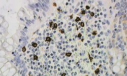 Biogenex Laboratories CD117 : T595 : 6mL, Quantity: Each of 1