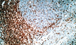 Biogenex Laboratories CD5 : 4C7 : 6mL, Quantity: Each of 1