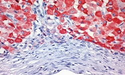 Biogenex Laboratories Inhibin Alpha : R1 :6mL, Quantity: Each of 1