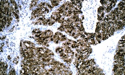 Biogenex Laboratories Renal Cell Carc : RCC-26 : 6mL, Quantity: Each of