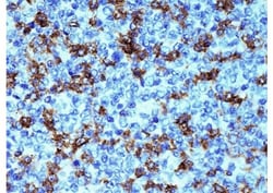 Biogenex Laboratories PD-1 : IHC001 : 6mL, Quantity: Each of 1