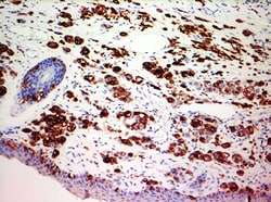 Biogenex Laboratories Melanoma : HMB45 : 1mL, Quantity: Each of 1