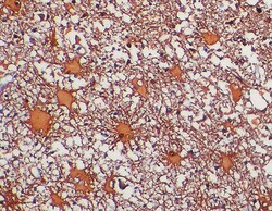 Biogenex Laboratories GFAP : GA-5 : 1mL, Quantity: Each of 1