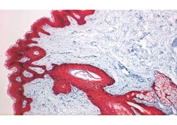 Biogenex Laboratories Cytokerain : AE1/AE3 : 1mL, Quantity: Each of 1