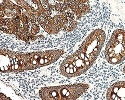 Biogenex Laboratories Cytokeratin 8 &18 : 5D3 : 1mL, Quantity: Each of