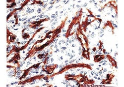 Biogenex Laboratories CD34 : QBEnd/10 : 1mL, Quantity: Each of 1