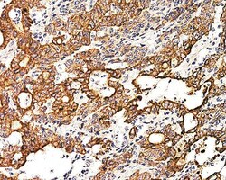 Biogenex Laboratories Cytokeratin 19 : RCK108 : 1mL, Quantity: Each of