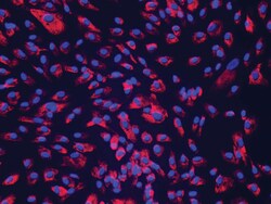 Lonza Walkersville NHCF-V – Human Ventricular Cardiac Fibroblasts, Quantity: