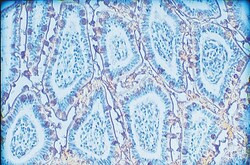 Vector Laboratories Jacalin Unconjugated 25 mg, Quantity: Each of 1