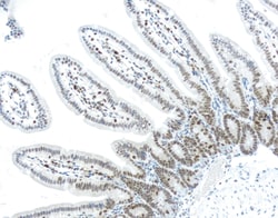 Vector Laboratories Mouse On Mouse (M.O.M.) ImmPRESS HRP (Peroxidase) Polymer