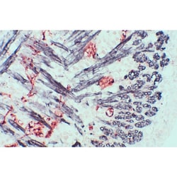 Vector Laboratories Vector M.O.M. (Mouse-On-Mouse) Immunodetection Kit,