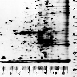 Electron Microscopy Sciences Autoradiography Ruler Set, 20 cm length, 4/pk,