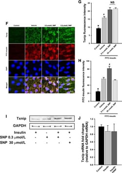 Sigma Aldrich Fine Chemicals Biosciences Insulin-FITC labeled human, 5