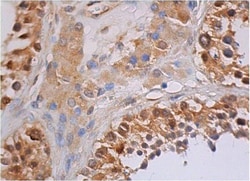 Santa Cruz Biotechnology ERK 1/2 Antibody (C-9), 200 ug/mL, Quantity: Each