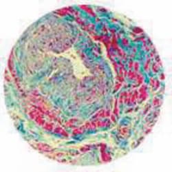 IMEB, Inc Masson Trichrome Stain Kit, Includes: 1- 8 Oz Bottle/Solutions:Bouin’s,