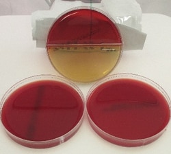 Oxyrase&nbsp;Oxypras 3-Pack: Bbe/Kvl Bi-Plate, Brucella, Pea 10/Pk