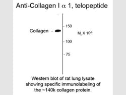 Rockland Immunochemicals Anti-Collagen I, alpha 1 telopeptide (Rabbit)
