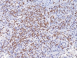 Biocare Medical, LLC PAX8 (M) Antibody - Concentrate, 1.0 ml, Quantity:
