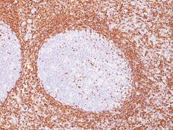 Biocare Medical, LLC Bcl-2 Antibody - Concentrate, 0.1 ml, Quantity: Each