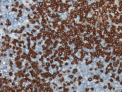 Biocare Medical, LLC CD20 [L26] Antibody - Concentrate, 1.0 ml, Quantity: