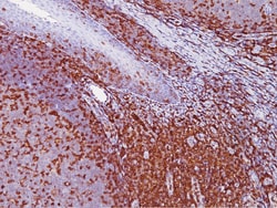 Biocare Medical, LLC CD43 Antibody - Concentrate, 0.1 ml, Quantity: Each