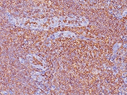 Biocare Medical, LLC CD45RO [UCHL-1] Antibody - Concentrate, 0.5 ml, Quantity: