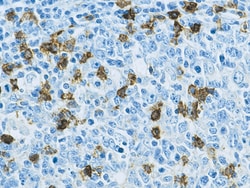 Biocare Medical, LLC CD57 (Natural Killer Cell) Antibody - Concentrate,