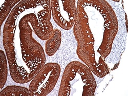 Biocare Medical, LLC Pan Cytokeratin [AE1/AE3] Antibody - Concentrate,