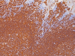 Biocare Medical, LLC Leukocyte Common Antigen (LCA) Cocktail Antibody -