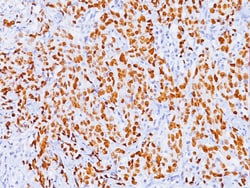 Biocare Medical, LLC p53 Tumor Suppressor Protein Antibody - Concentrate,