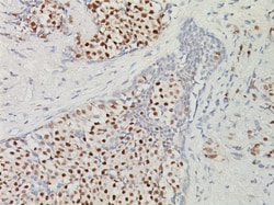 Biocare Medical, LLC Estrogen Receptor (ER) [1D5] Antibody - Concentrate,