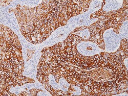 Biocare Medical, LLC Cytokeratin LMW (8/18) Antibody - Concentrate, 1.0