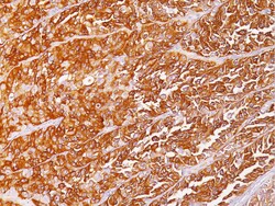 Biocare Medical, LLC HMB45 Antibody - Concentrate, 1.0 ml, Quantity: Each