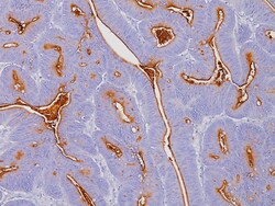 Biocare Medical, LLC Carcinoembryonic Antigen Antibody - Concentrate, 1.0