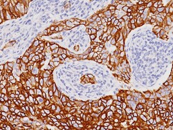 Biocare Medical, LLC Cytokeratin 7 (CK7) Antibody - Concentrate, 0.5 ml,