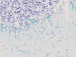 Biocare Medical, LLC Neurofilament Antibody - Concentrate, 0.5 ml, Quantity: