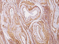 Biocare Medical, LLC Muscle Specific Actin Antibody - Concentrate, 0.1