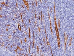 Biocare Medical, LLC CD34 Antibody - Concentrate, 1.0 ml, Quantity: Each