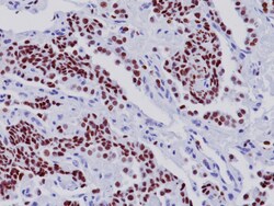 Biocare Medical, LLC TTF-1 Antibody - Concentrate, 0.1 ml, Quantity: Each