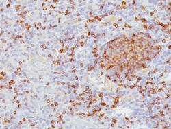 Biocare Medical, LLC CD5 Antibody - Concentrate, 0.1 ml, Quantity: Each
