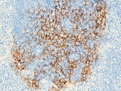 Biocare Medical, LLC CD23 Antibody - Concentrate, 1.0 ml, Quantity: Each