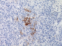 Biocare Medical, LLC Gross Cystic Disease Fluid Protein-15 Antibody - Concentrate,